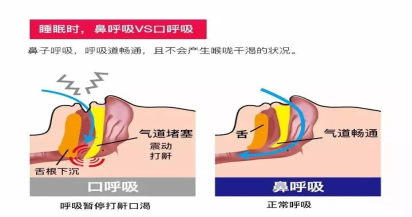 0129 孩子睡觉老张嘴，为啥？188.png