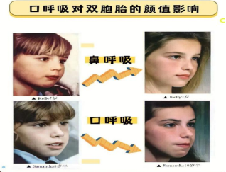 0129 孩子睡觉老张嘴，为啥？732.png