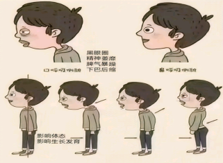 0129 孩子睡觉老张嘴，为啥？907.png